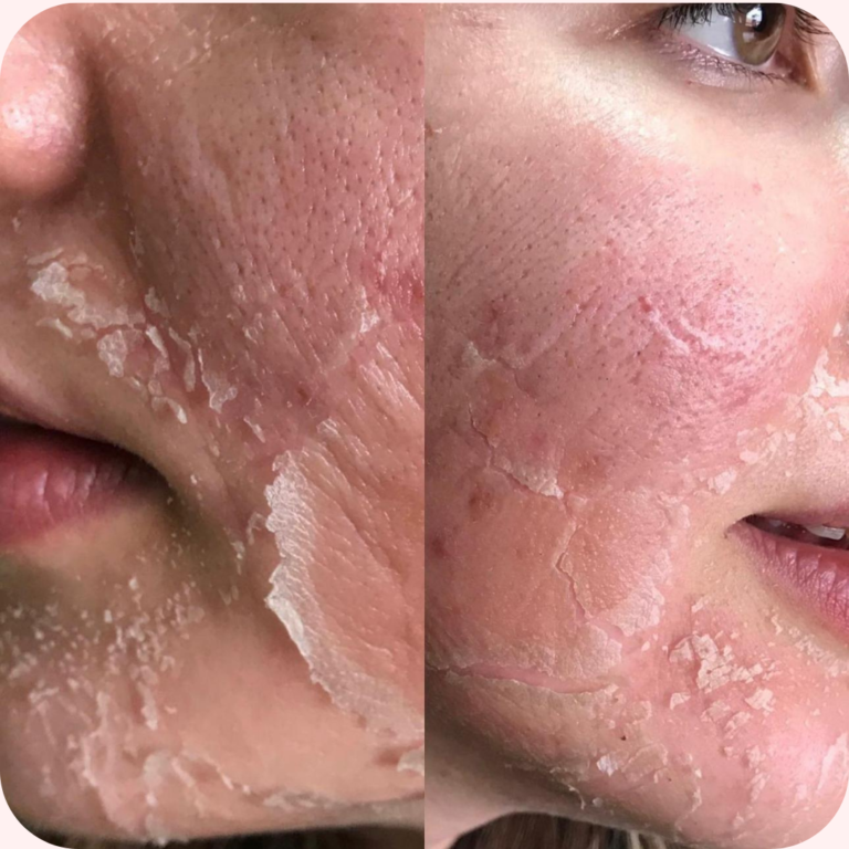 Yosun Peeling / Dr.Algler